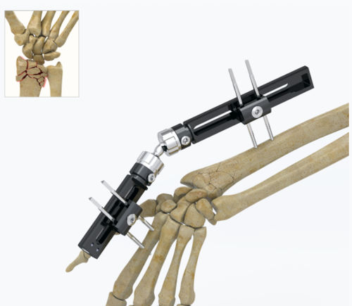 Fijador externo para muñeca - 5034 series - Zimed Medical - tubular / para adulto