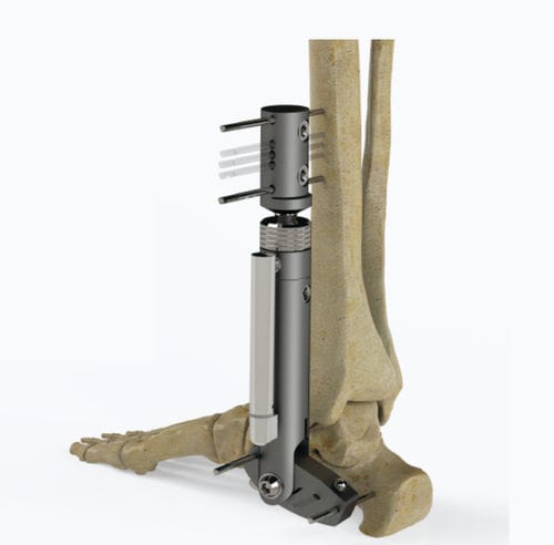 Fijador externo para tobillo - 5064-000 series - Zimed Medical - tubular / para adulto
