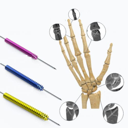 Tornillo de compresión ósea para mano - Zimed Medical - canulado / sin cabeza / metálico