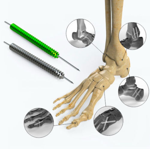 Tornillo de compresión ósea para pie - Zimed Medical - canulado / sin cabeza / metálico