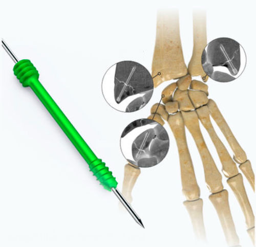 Tornillo de compresión ósea para mano - Zimed Medical - canulado