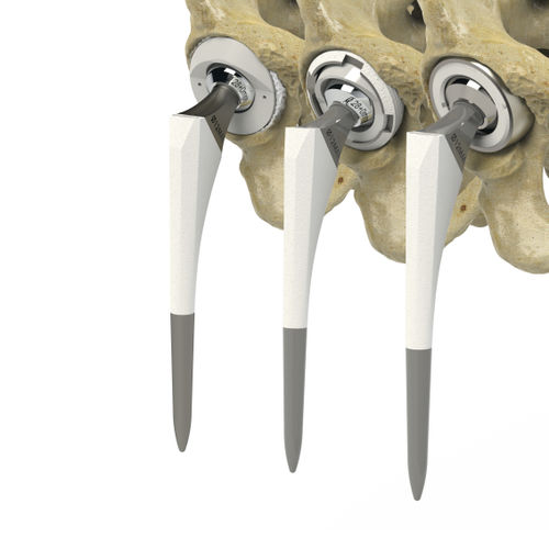 Prótesis de cadera de primera intención - 7022-4 series - Zimed Medical - no cementada