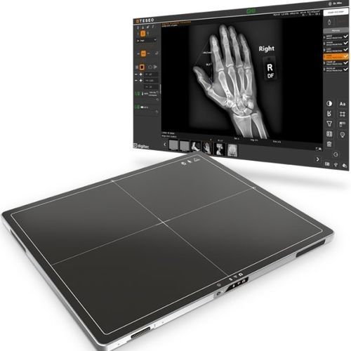 Panel detector plano para radiografía polivalente - TeseoX - Digitec - portátil / inalámbrico