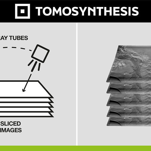 Software médico - Digital Tomosynthesis - Digitec - de radiografía / de diagnóstico / de postprocesamiento