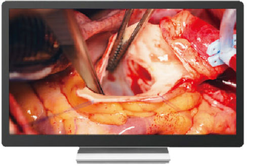 Monitor de diagnóstico - imedtac - quirúrgico / 4K / 32"