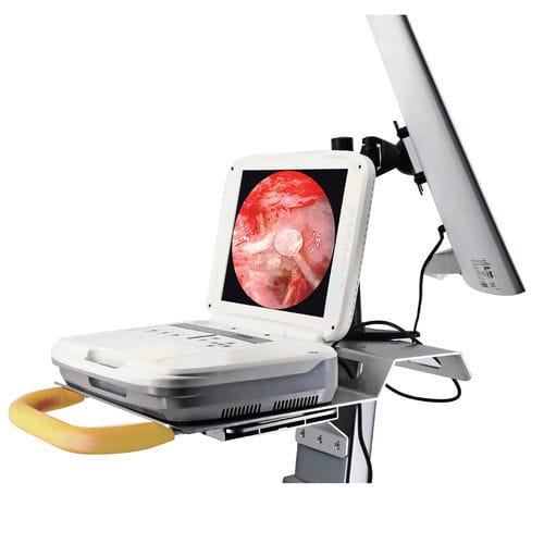 Columna de endoscopia para neurocirugía endoscópica - 1080P - Hotry