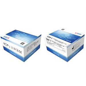 Prueba rápida para COVID-19 - Zhongshan Chuangyi Biochemical Engineering Co.,ltd - de IgG / de IgM / SARS-COV-2