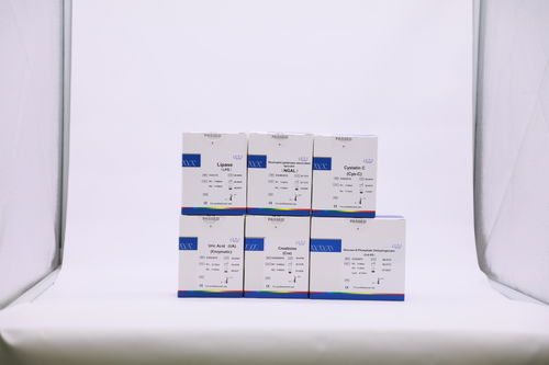 Kit de prueba de enfermedades renales - GS8301S - Beijing Strong Biotechnologies, Inc - de creatinina / de orina / por plasma