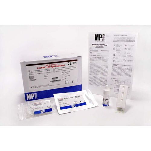 Prueba rápida para anticuerpos - 0743130020 - MP Biomedicals - de hepatitis C / VHC / de suero