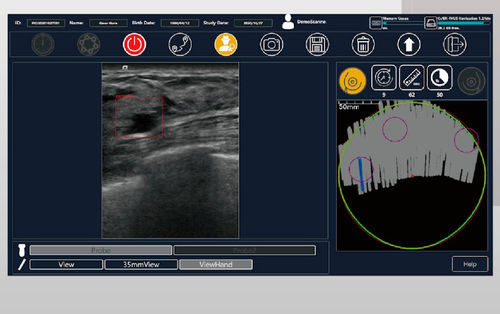Software para ecografía - BR-FHUS Navigation™ - TaiHao Medical - visualizador / de diagnóstico / para detección del cáncer de mama