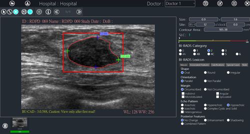 Software de análisis de imágenes - BU-CAD™ - TaiHao Medical - para informes / de diagnóstico / de interpretación