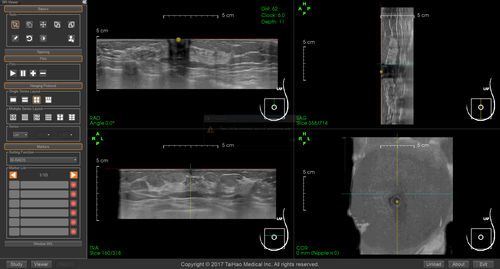 Software para informes - BR-Viewer™ - TaiHao Medical - visualizador / de diagnóstico / para detección del cáncer de mama