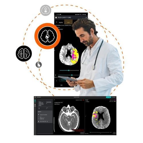 Software de tratamiento - Olea Medical - médico / de emergencia