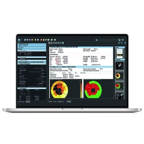 Software de análisis - SPHERE® 3.0 - Olea Medical - de visualización / de medición / de cartografía cardíaca