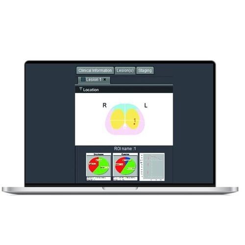Software para IRM - SPHERE® 3.0 - Olea Medical - de medición / de análisis de imágenes / análisis de datos