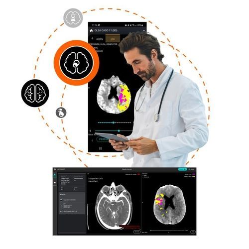 Software de análisis de imágenes - Olea Medical - médico / TDM / de pulmón
