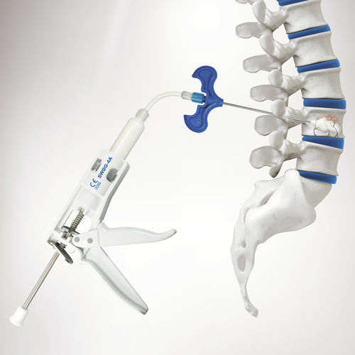 Kit de instrumentos para la inyección de cemento óseo - SPASY BCD ™  - Seawon Meditech