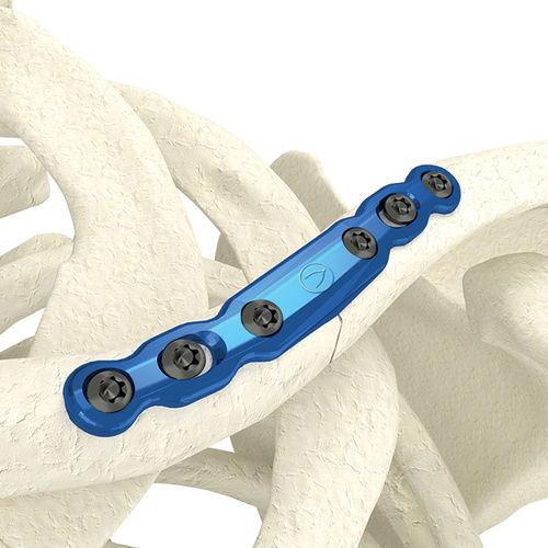 Placa de compresión para clavícula - PK-SMC0635NL-TI - WishBone Medical - porción medial / metálica / pediátrica