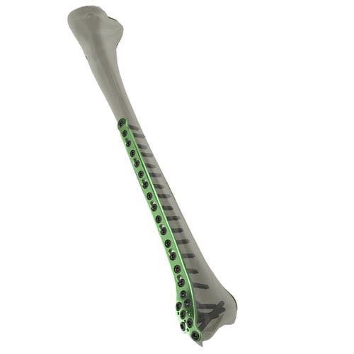 Placa de compresión para tibia - WishBone Medical - porción distal / bloqueada / de titanio