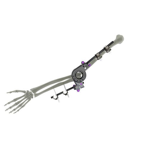 Fijador externo para codo - UniX® - WishBone Medical - tubular / para adulto