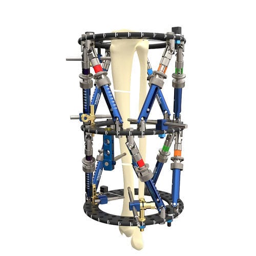 Fijador externo para tibia - Smart Correction®  - WishBone Medical - para peroné / para húmero / circular