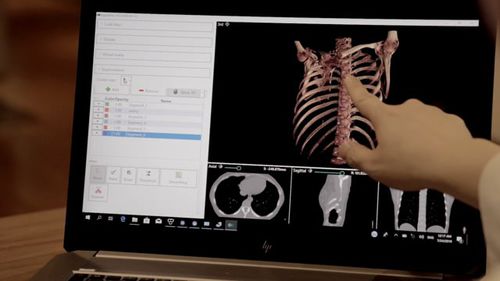 Software de visualización 3D - DigiTwin - Medical Augmented Intelligence (MAI) - de diagnóstico / de intercambio / de tratamiento