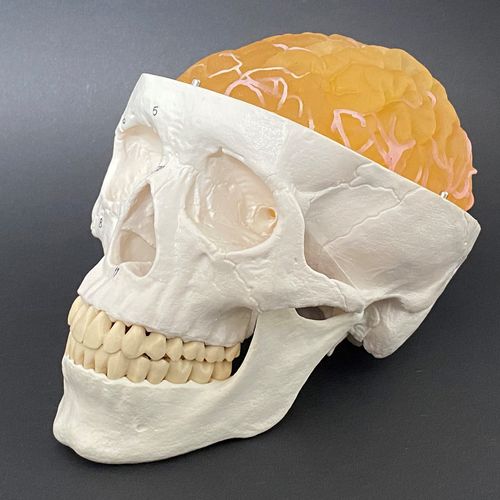 Modelo anatómico de tumor - Schiner3DRepro - de cerebro / de neurocirugía / de formación