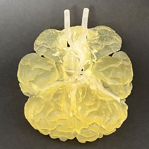 Modelo anatómico de arteria - Circulus Willisii - Schiner3DRepro - del círculo arterial cerebral / de cerebro / de neurocirugía