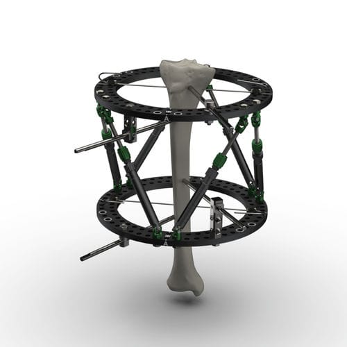 fijador externo modular - TASARIMMED