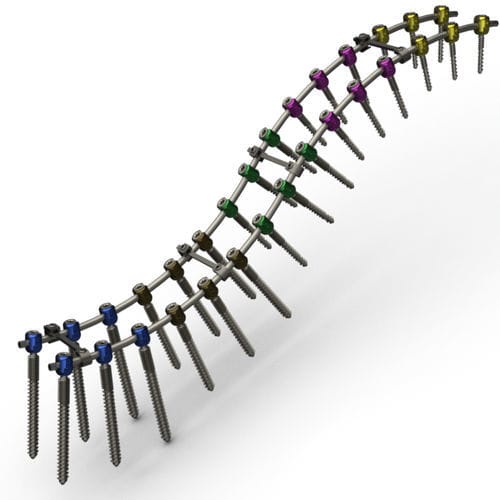 Sistema de osteosíntesis toraco-lumbo-sacro - RPT series - TASARIMMED - vía posterior / para adulto