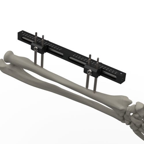 Fijador externo para muñeca - TF-ERS  - TASARIMMED - para radio / para cúbito / tubular
