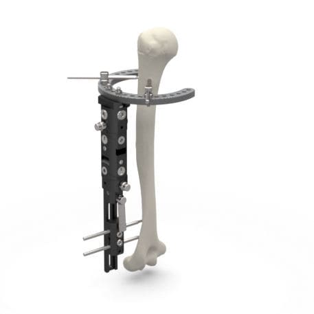 Fijador externo para tarso - MAF - TASARIMMED - para articulación metacarpofalángica / híbrido / pediátrico