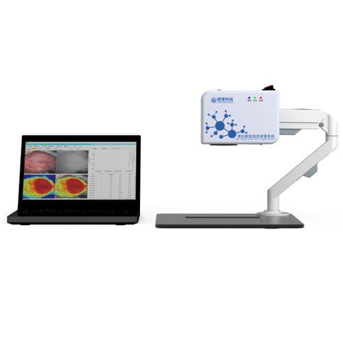 Reproductor de imágenes de flujo sanguíneo - Shanghai TOW Intelligent Technology - por contraste de moteado láser