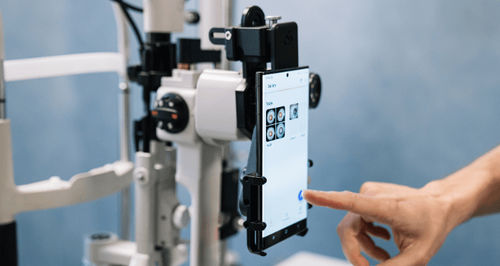 Adaptador para smartphone para lámpara de hendidura - OPTIREC - Custom Surgical