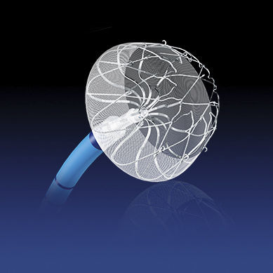 Dispositivo de oclusión para la oclusión de la aurícula izquierda - YFDQ-20-1 - Nanjing MDP Medical Technology