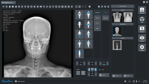 Módulo de software de radiografía - RayinView - Astel - de análisis de imágenes / de visualización DICOM / de grabación de vídeo