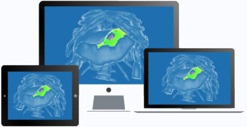Software quirúrgico - diSplay - InSimo - médico / clínico / de anatomía