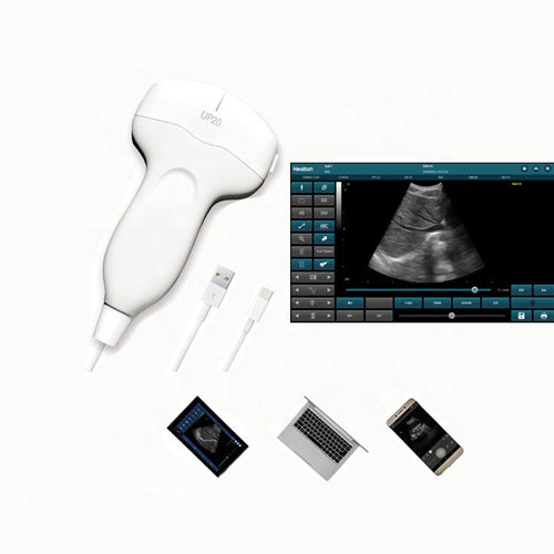 Ecógrafo de mano - HS-UP20 - Healson Technology - para ecografía ginecológica y obstétrica / para ecografías abdominales y pélvicas / para ecografía de mama