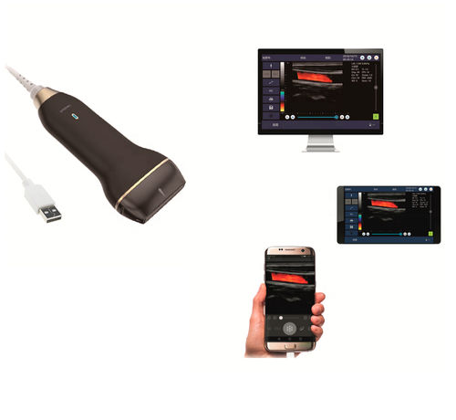 Ecógrafo de mano - C30L - Healson Technology - para ecografía musculoesquelética / para ecografía cutánea / para ecografía intraoperatoria