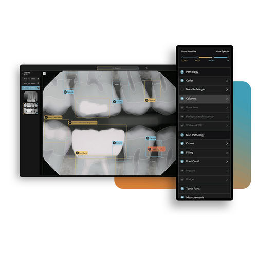 Plataforma de IA para radiografía dental - Second Opinion® - Pearl - de análisis de imágenes