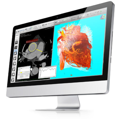Software SPECT - Pixmeo SARL - médico / clínico / para imágenes médicas