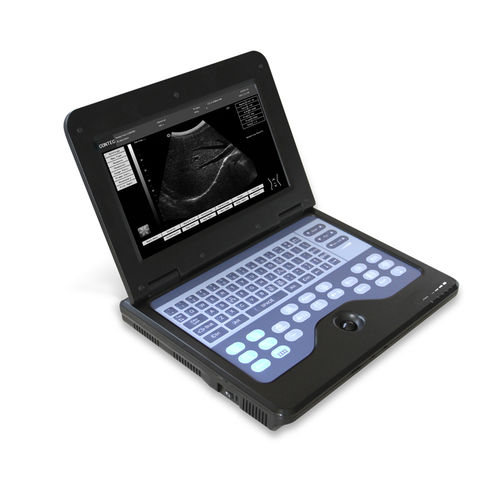ecógrafo portátil - Contec Medical Systems