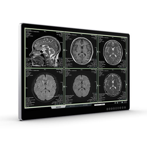 Monitor para imágenes médicas - UHD Surgical Monitor - Vecoton Technology - quirúrgico / 4K / antideslumbrante