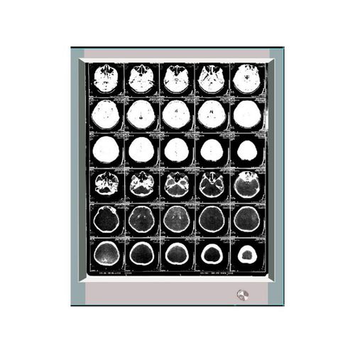 Negatoscopio 1 pantalla - GP1001A - Bellamoon Medical - LED