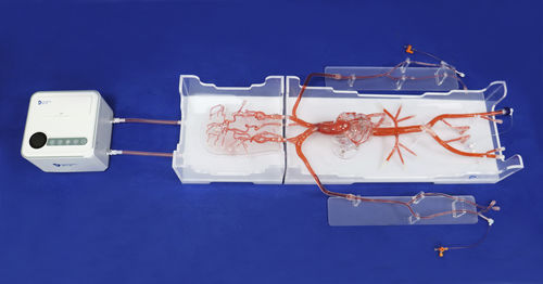 modelo vascular de angiografía - Trando 3D Medical Technology