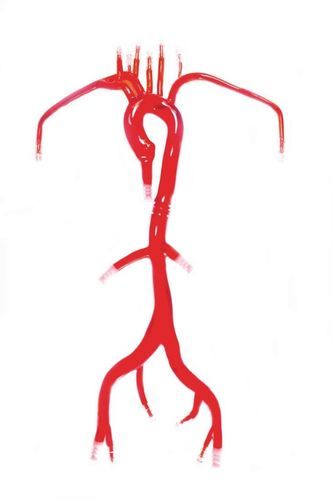 Modelo vascular de arteria femoral - Trando 3D Medical Technology - de la arteria carótida común derecha / de la arteria carótida común izquierda / de la arteria subclavia derecha