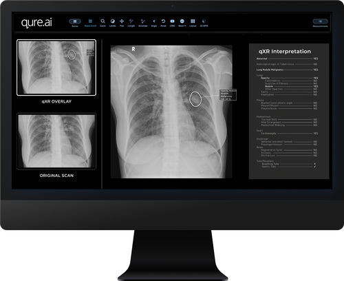 Software para informes - qXR - Qure.ai - de interpretación / de detección / de radiología
