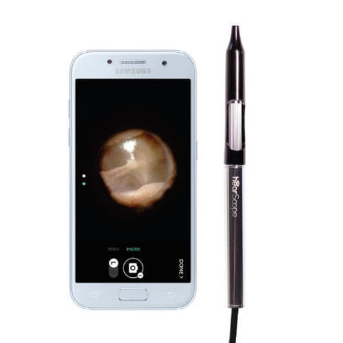 Videotoscopio con espéculo - hearScope™ - hearX Group