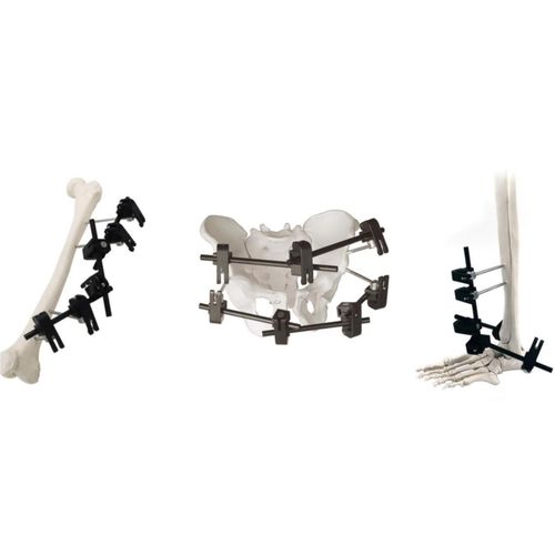 Fijador externo modular - QuickX  - Zhejiang Borumon Biological Technology - tubular / para adulto
