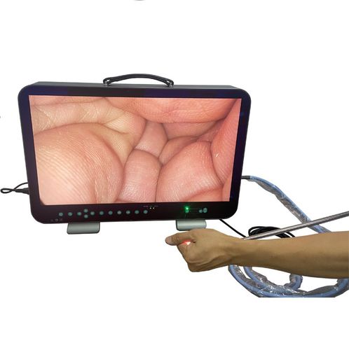 Cámara para endoscopio - E33 - Shantou Easywell Electronic Technologies - médica / quirúrgica / digital